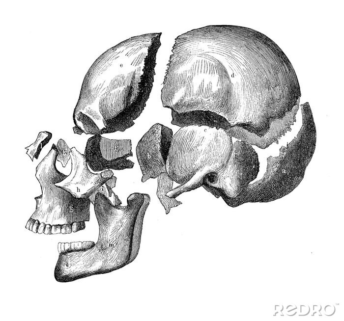 Poster  Illustration vintage d'anatomie, crâne avec mâchoire et dents, vue de décomposition osseuse